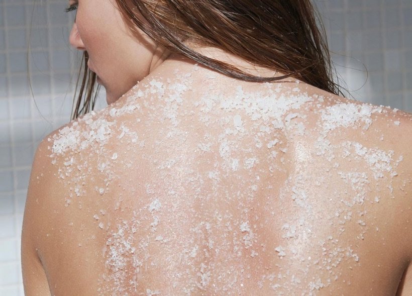How to get rid of pimples on your back 1