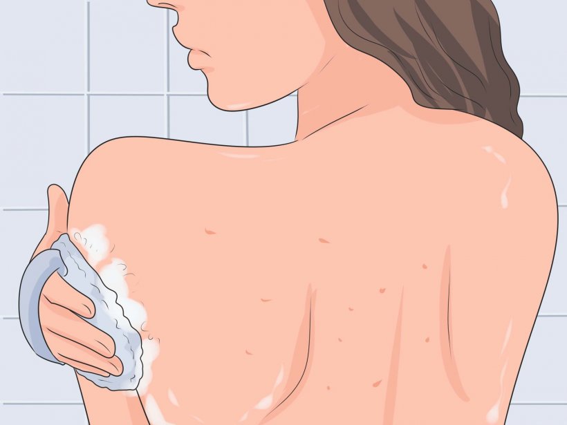 How to get rid of pimples on your back 3