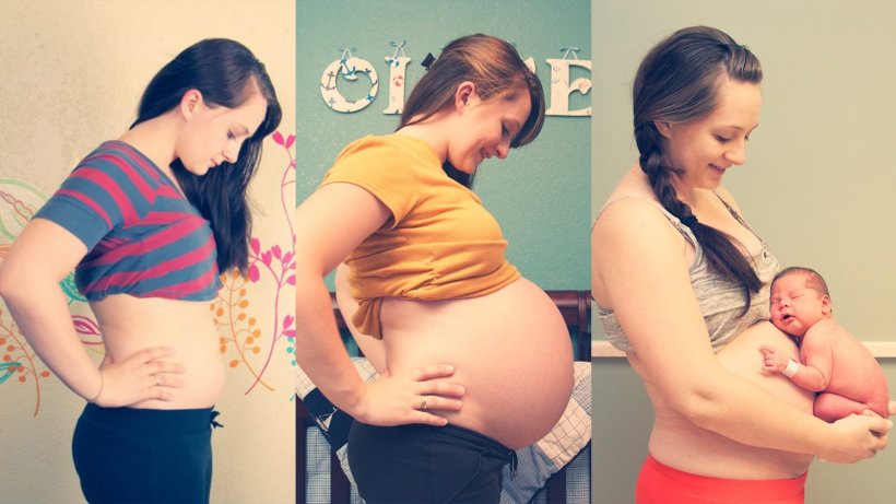 Сыпь на животе при беременности фото