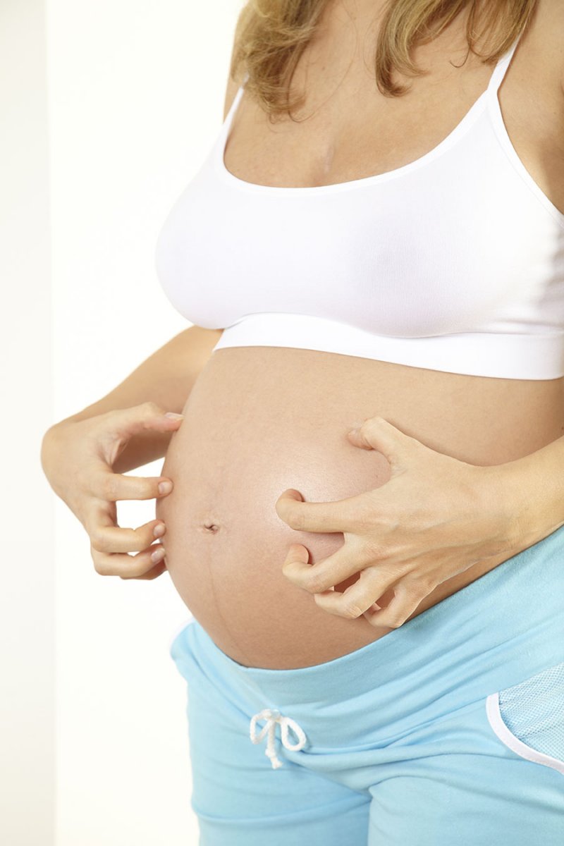 почему при беременности чешется живот и грудь фото 111